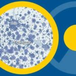Де шукати інформацію про КТ та МРТ? НСЗУ запустила новий дашборд із даними ЕСОЗ
